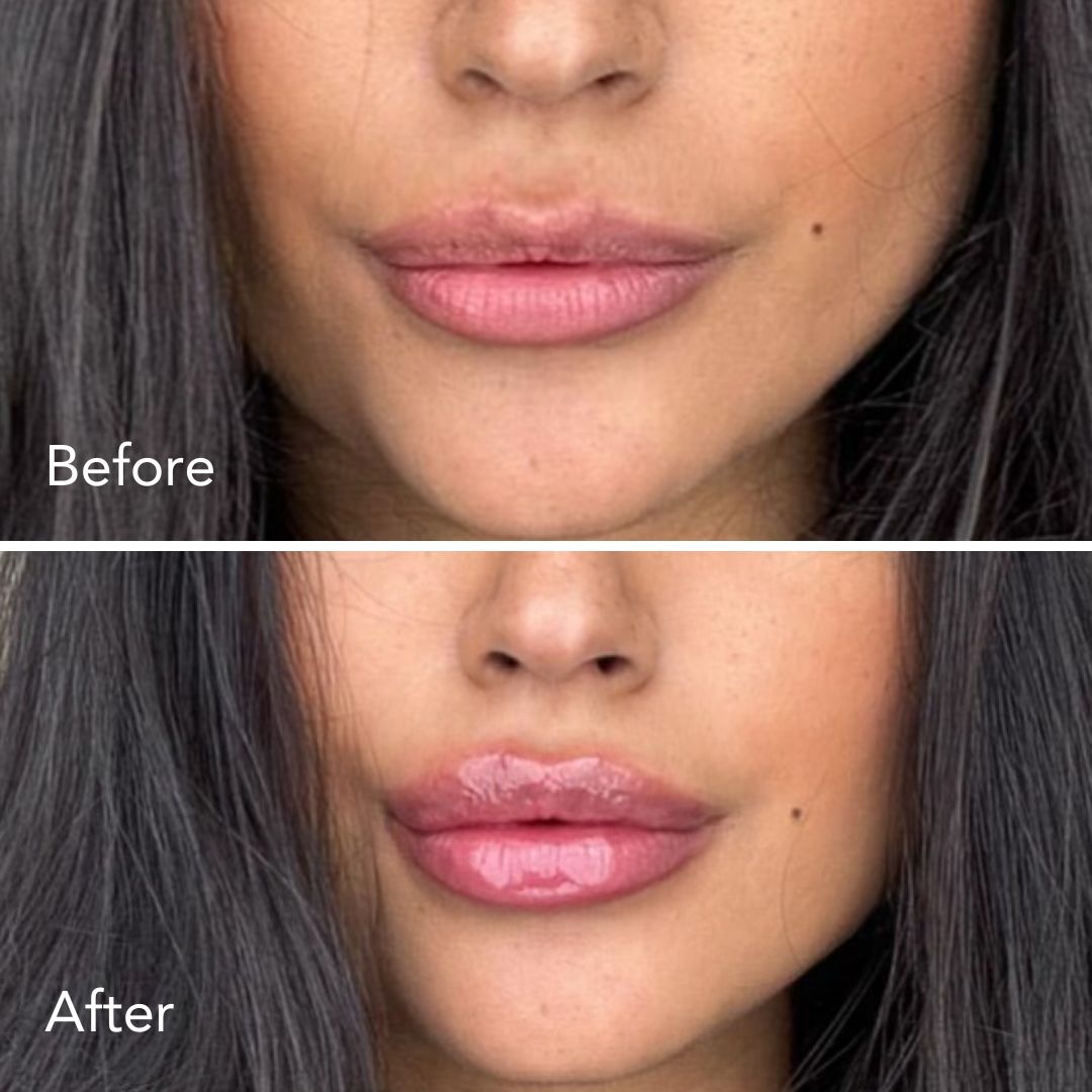 Luscious Lips Natural Plumper