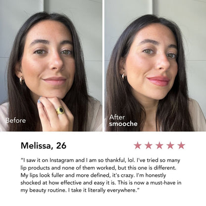 Luscious Lips Natural Plumper